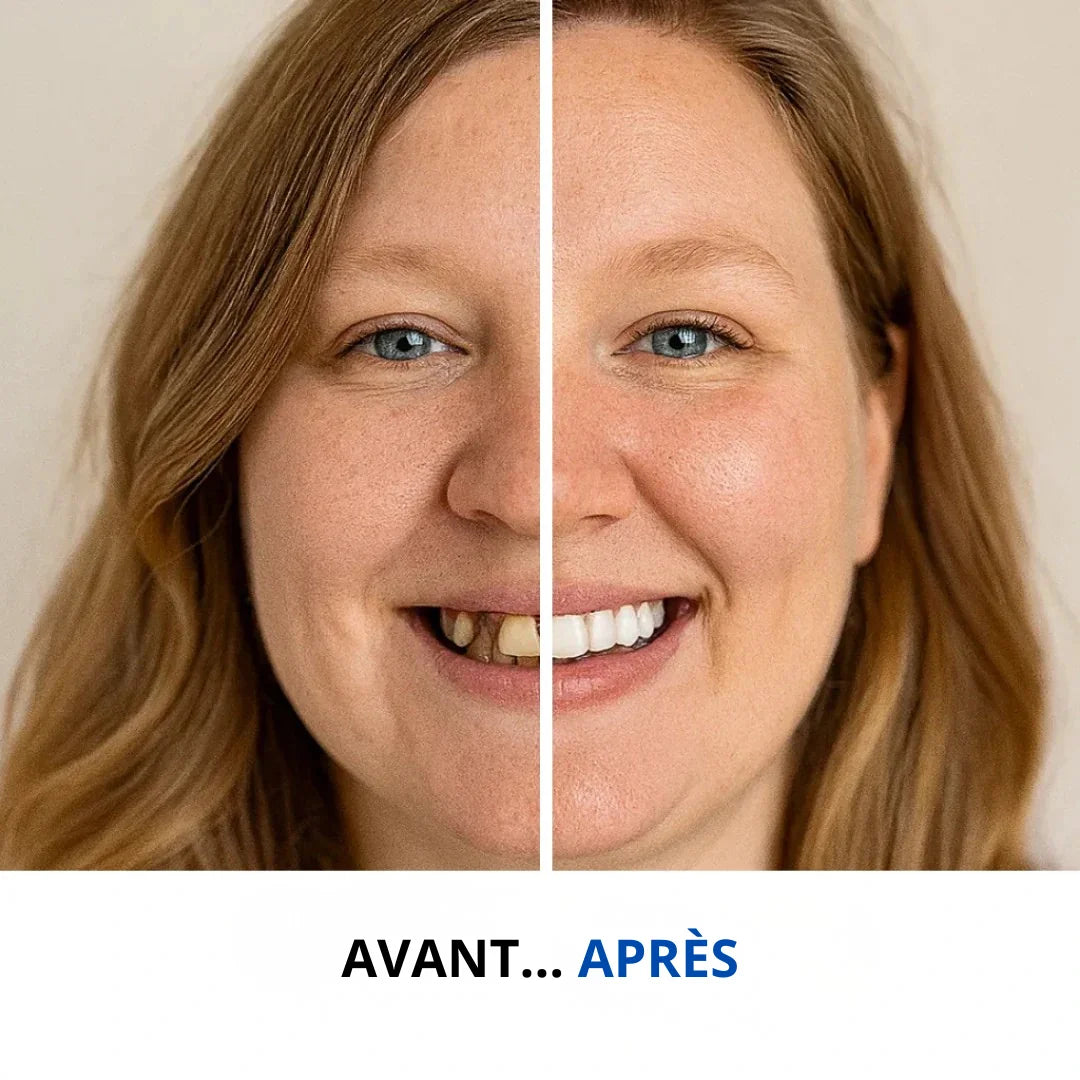 Facettes dentaires réutilisables – Sourire Instantané™