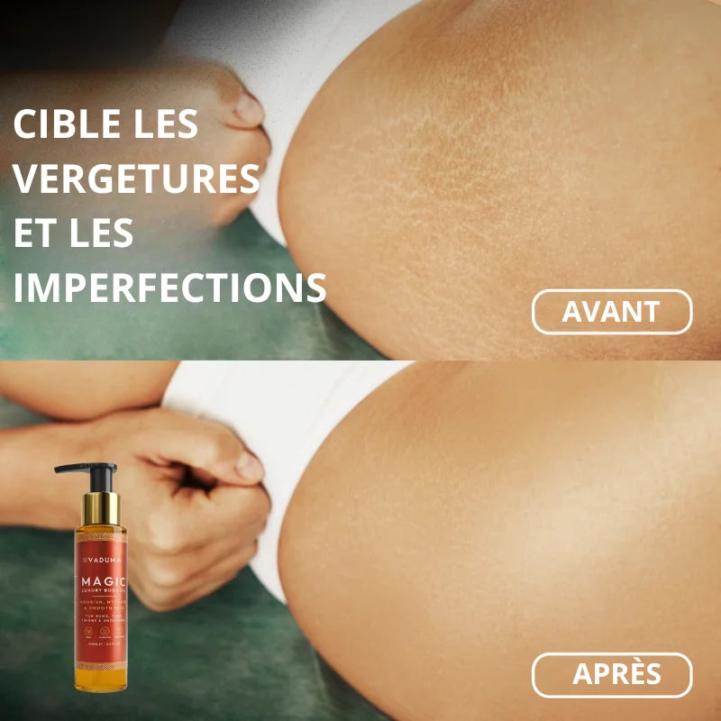 Huile Botanique Raffermissante