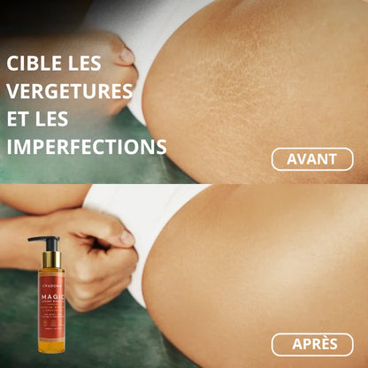 Huile Botanique Raffermissante