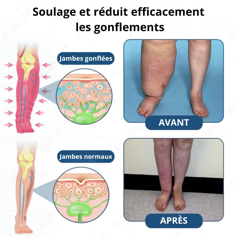 Roll-On Anti-Gonflement