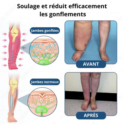 Roll-On Anti-Gonflement