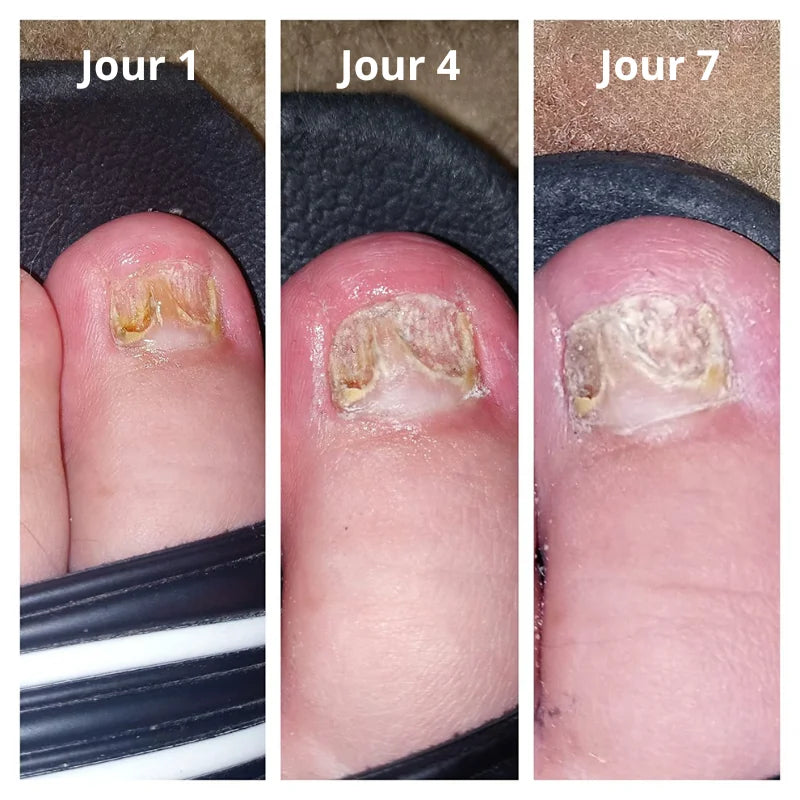 Sérum Réparateur Ongles Kératine