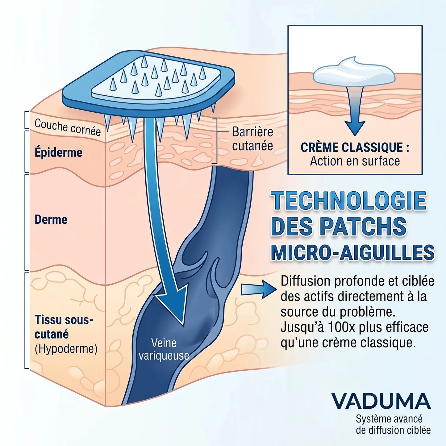 Patch Anti-Varices