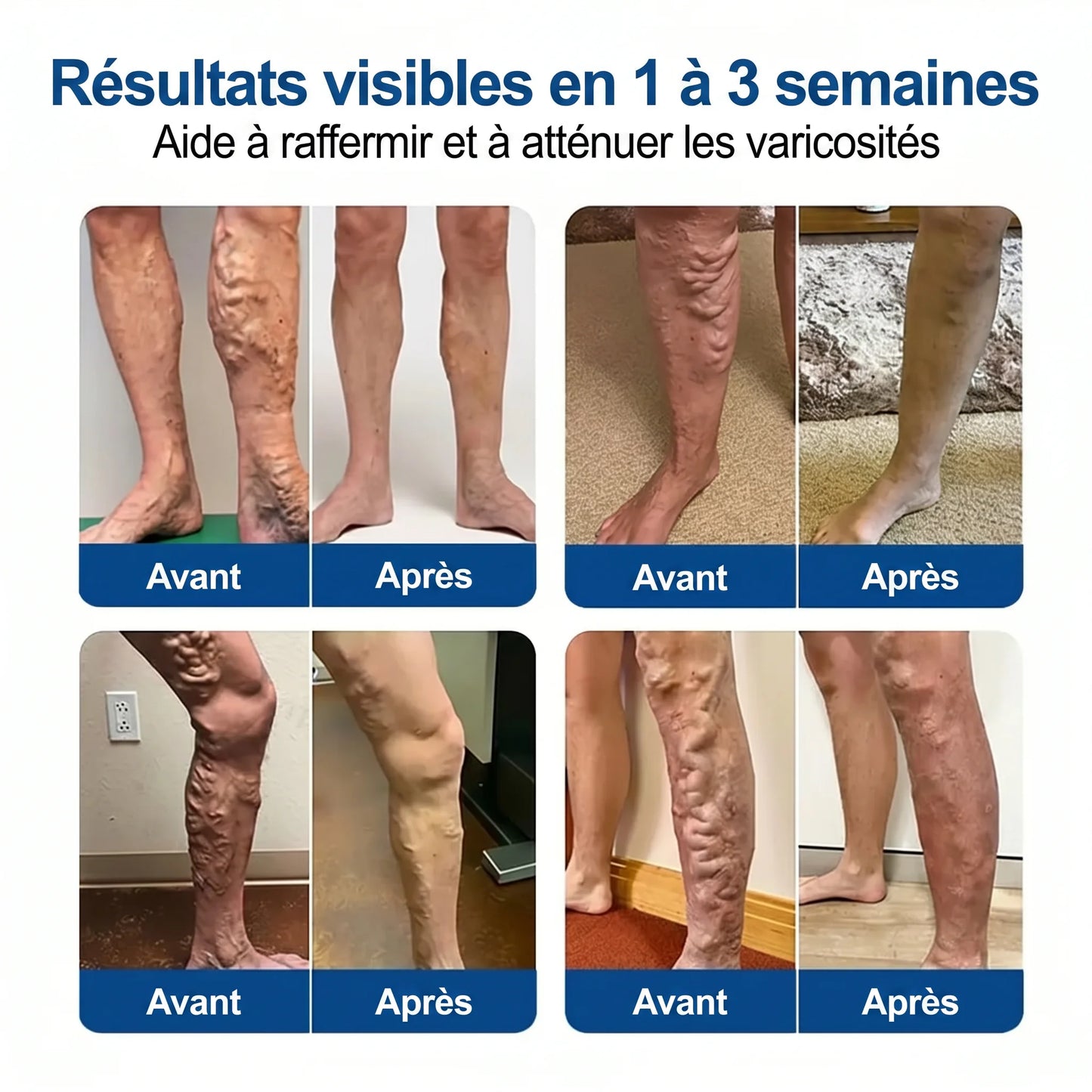 Patch Anti-Varices